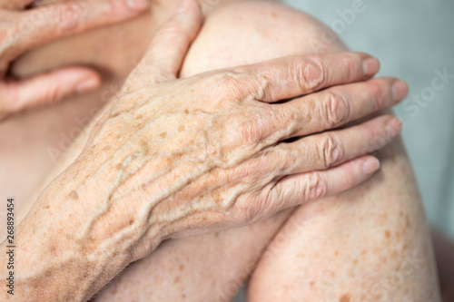 Hand with spots of old age photo