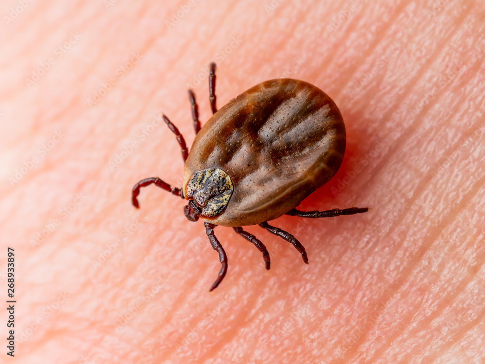 Encephalitis Virus or Lyme Borreliosis Disease Infectious Dermacentor Tick Arachnid Parasite Insect on Skin Macro Encephalitis Virus or Lyme Borreliosis Disease Infectious Dermacentor Tick Arachnid Parasite Insect on Skin Macro