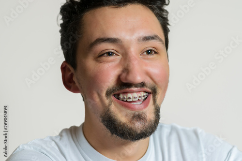 Portrait of a young man with braces smiling and laughing. A happy young man with braces on a white background