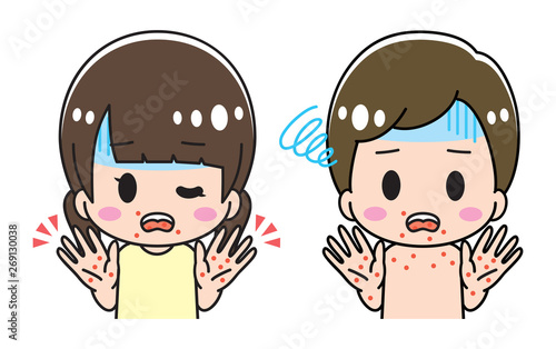 Hand foot and mouth disease children