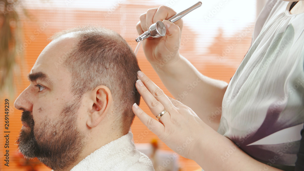 Hairdresser cure male bald head with spray gun Hairdresser cure male bald head with spray gun