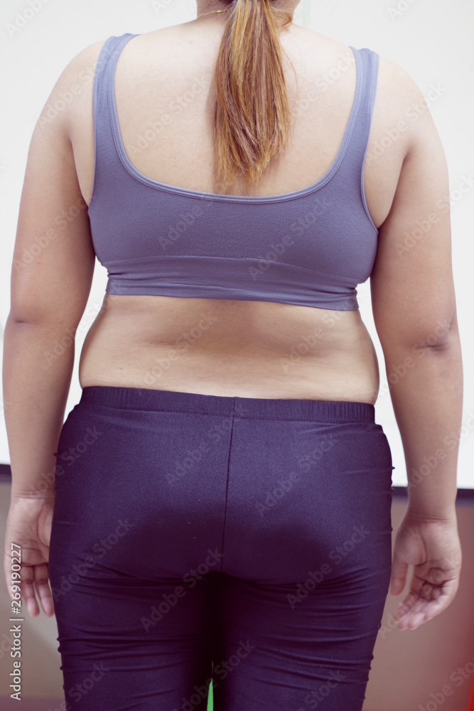 Women with fat belly and stretch marks. - Women with fat belly and stretch marks. -