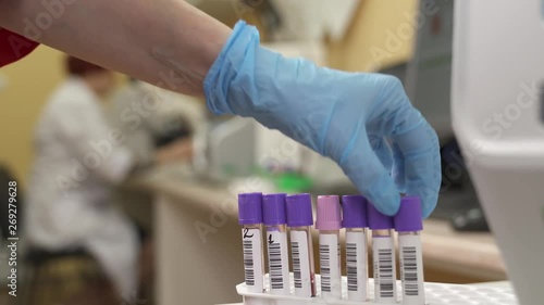 A close-up of medical technologist taking out blood test tubes from hematology analyzer. Completed tests. Blurred background. Scientific and healthcare research concept