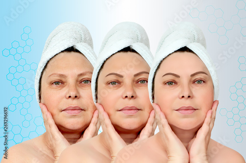 Portrait of a woman in three stages, with a problem and clear skin, the concept of aging and youth, beauty treatments and lifting. The process of aging and rejuvenation