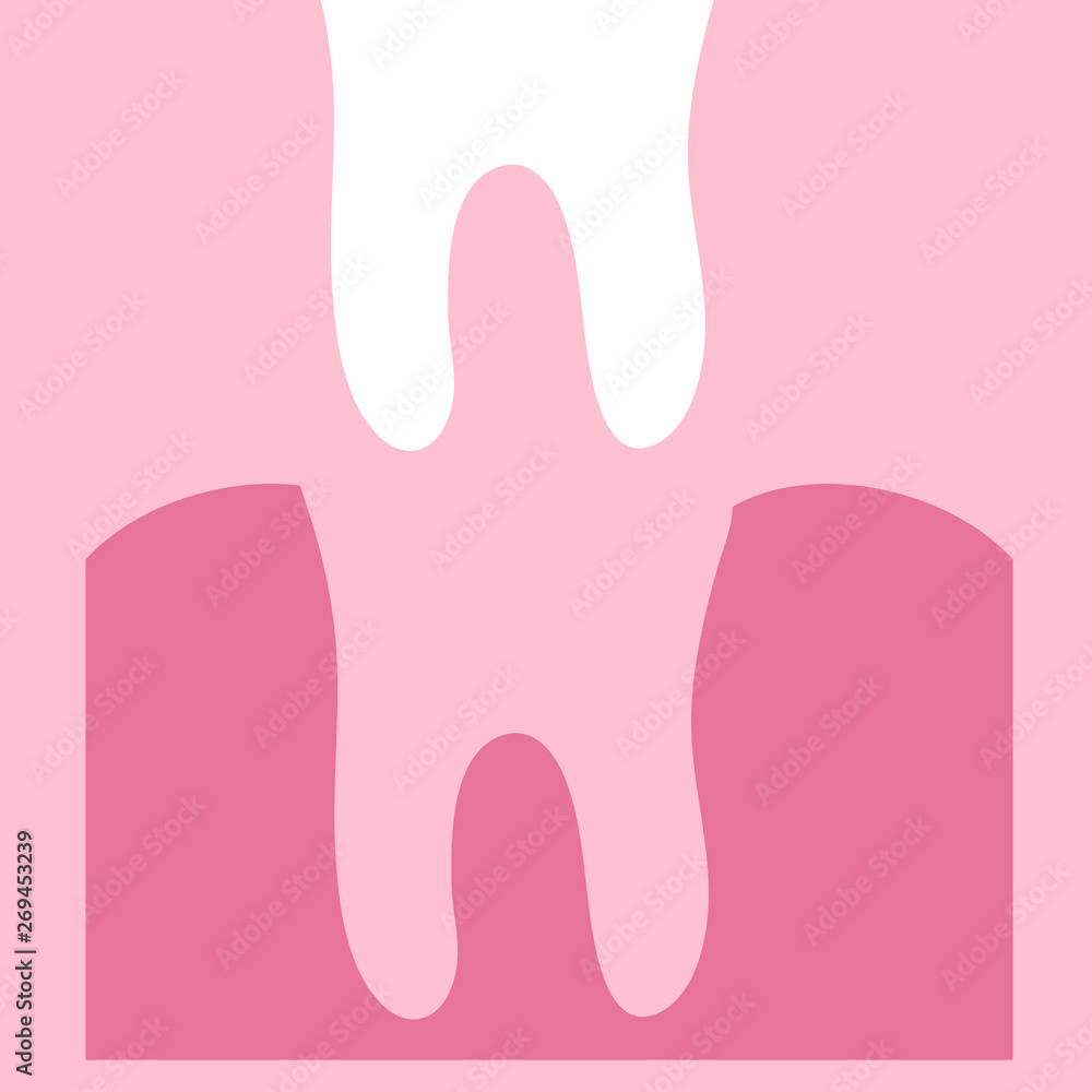 Removal of a tooth. Tooth and gum on a pink background. Dentistry Vector illustration. Removal of a tooth. Tooth and gum on a pink background. Dentistry Vector illustration.