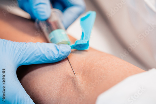 Wallpaper Mural Plasma lifting - Closeup of doctor's hand - blood test from a vein - diagnosis Torontodigital.ca