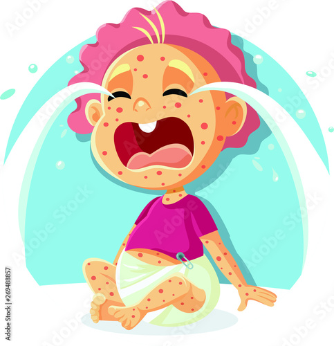  Sick Crying Baby with Measles Illustration