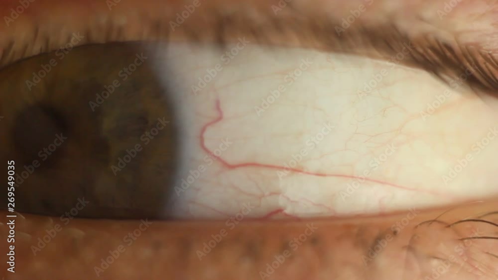 blinking male eye close-up looking around. red artery on the eyeball macro. pupil reaction to light. Mioz and Midriaz. closing and opening the eyelid blinking male eye close-up looking around. red artery on the eyeball macro. pupil reaction to light. Mioz and Midriaz. closing and opening the eyelid