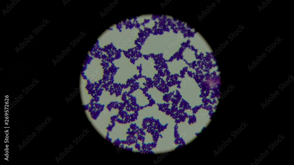 Researching of human biological sample using microscope. Biochemical identification of staphylococcus bacteria Researching of human biological sample using microscope. Biochemical identification of staphylococcus bacteria