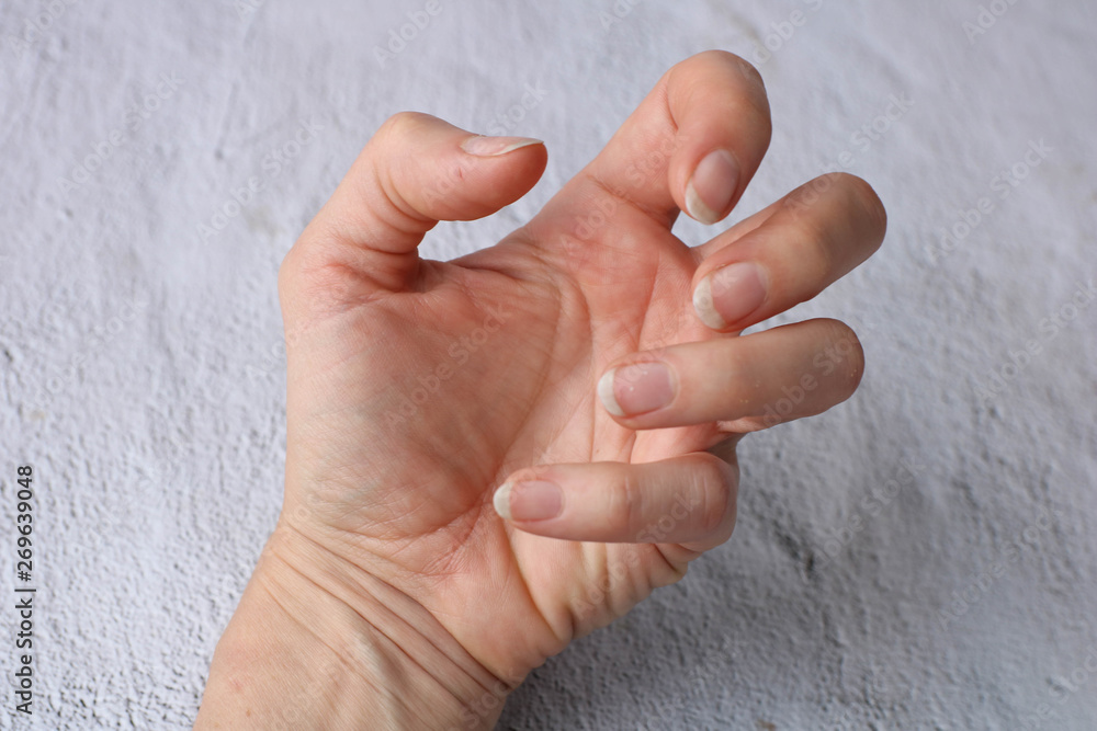Close up dirty hand nails on white background have copy space for put text. Concept unhealthy because can have bacteria make sick people Close up dirty hand nails on white background have copy space for put text. Concept unhealthy because can have bacteria make sick people