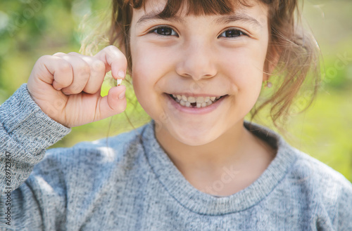 The kid had a baby tooth. Selective focus. photo