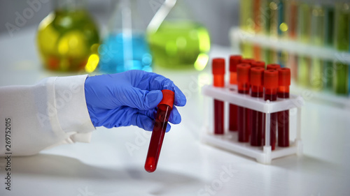 Biochemist checking blood serum reaction in test sample, health check-up photo