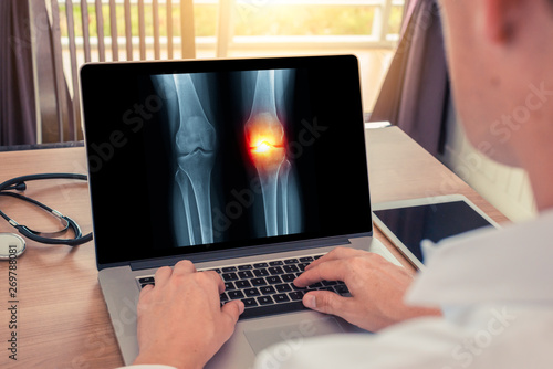 Doctor watching a x-ray about pain in the knee. Radiology concept