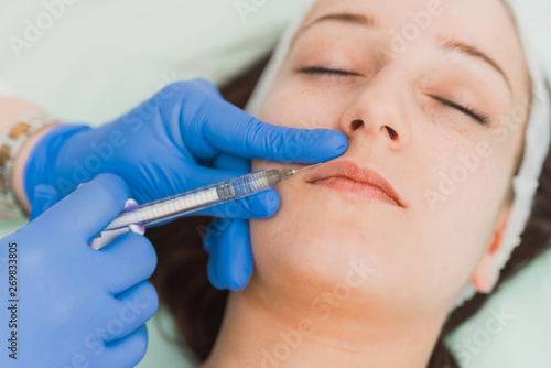 Lip fillers treatment