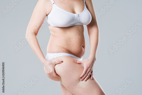 Overweight woman with fat legs, obesity female body on gray background