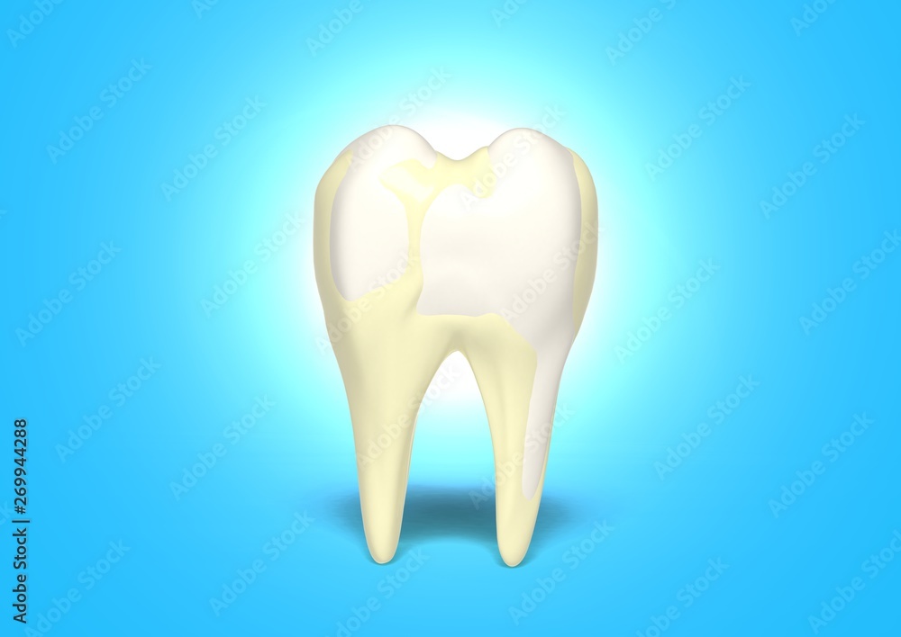 3d render Tartar and bacterial tooth plaque, Strong healthy tooth 3d render Tartar and bacterial tooth plaque, Strong healthy tooth