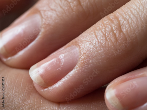 Damaged nails after gel polish. Close up.  photo