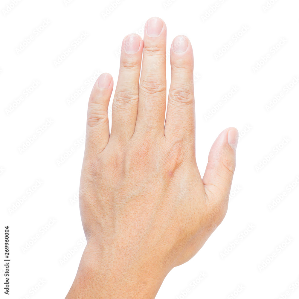 clinodactyly fingers isolated on white background isolated fifth finger clinodactyly Dupuytren disease and Disabled Hands clinodactyly fingers isolated on white background isolated fifth finger clinodactyly Dupuytren disease and Disabled Hands