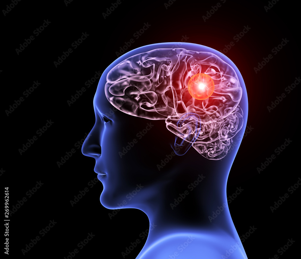 Obraz premium Human headache migraine