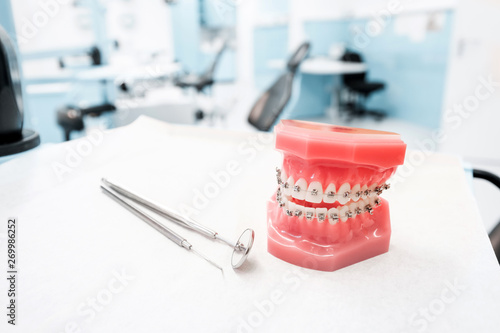 dental model with braces - Teeth orthodontic dental model with dental braces in dentist clinic - photo