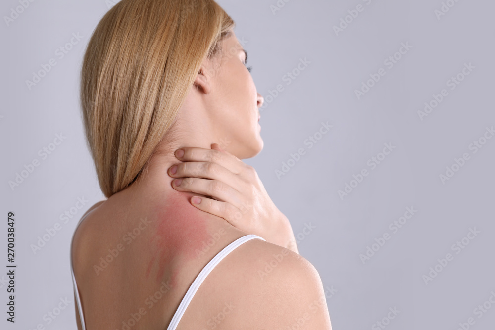 Woman with allergy symptoms scratching neck on grey background. Space for text Woman with allergy symptoms scratching neck on grey background. Space for text