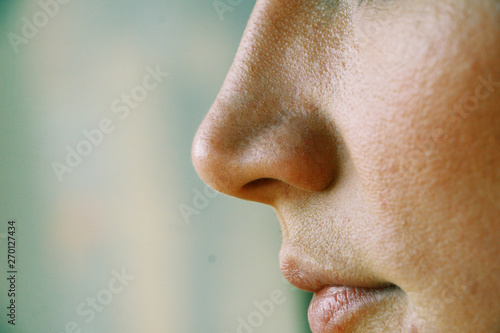 enlarged pores on the girl's face close up photo