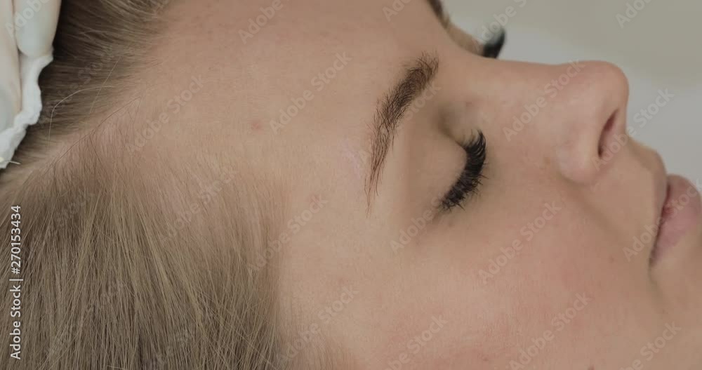Young attractive woman receives mesotherapy for hair. Girl receives an injection in the head. Close up. Young attractive woman receives mesotherapy for hair. Girl receives an injection in the head. Close up.