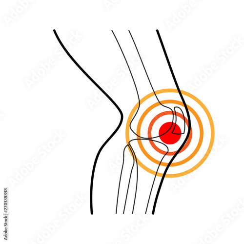 Ból kolana. Ilustracja wektorowa