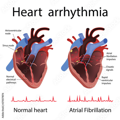 heart anatomy and types of heart disease vector illustration