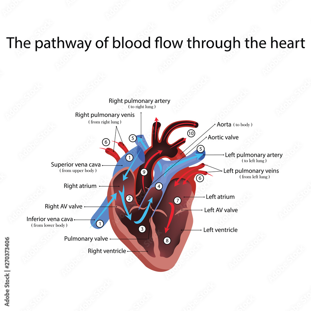 heart anatomy and types of heart disease vector illustration Stock ...