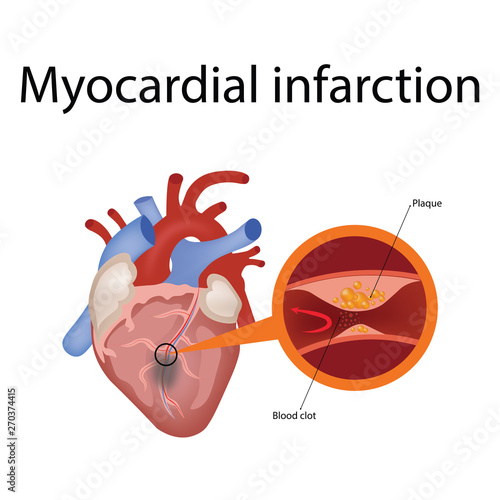 heart anatomy and types of heart disease vector illustration