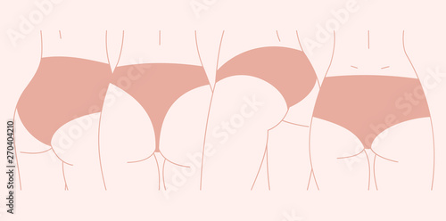 Different body and lingerie type. Feminine illustration. Vector illustration