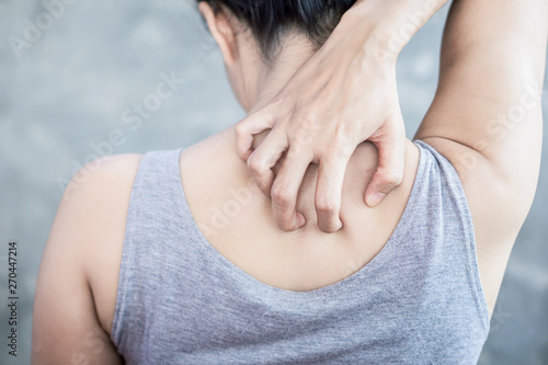 woman hand scratching her  skin itchy because of allergy to hot weather   