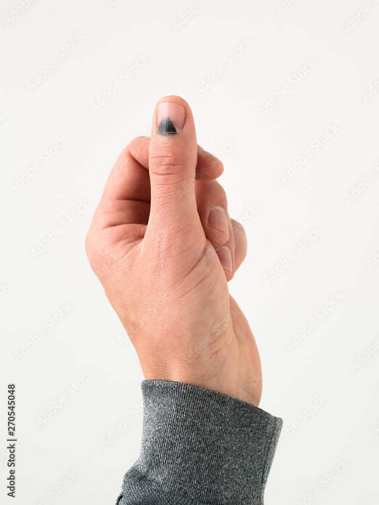 Fototapeta premium Black thumbnail after injury