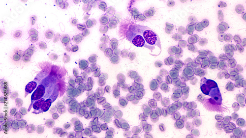 Photography Photomicrograph of specimen obtained by bronchoscopy, a type of endoscopy of lung, showing clusters of ciliated columnar epithelial cells