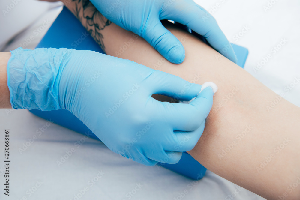 partial view of doctor in latex gloves preparing patient for injection partial view of doctor in latex gloves preparing patient for injection