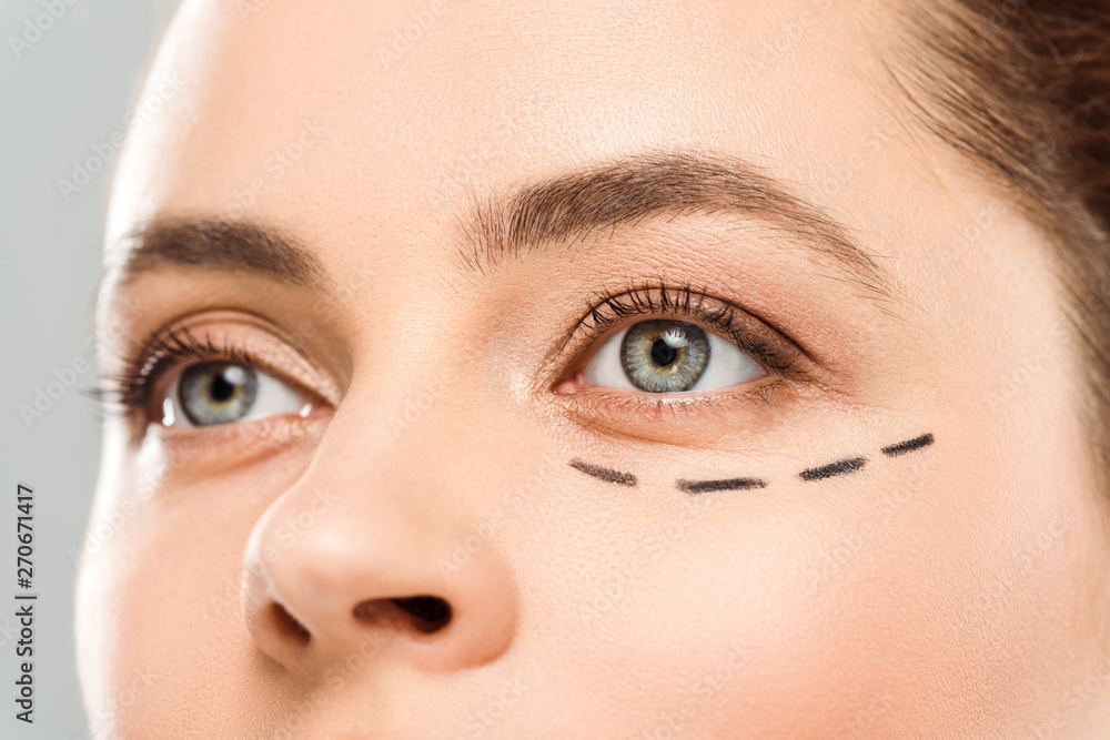 cropped view of woman with marks on face isolated on grey cropped view of woman with marks on face isolated on grey