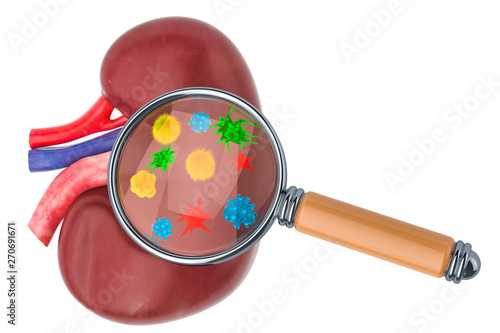 Research and diagnosis of kidney diseases concept. Human kidney with viruses and bacterias under magnifying glass, 3D rendering