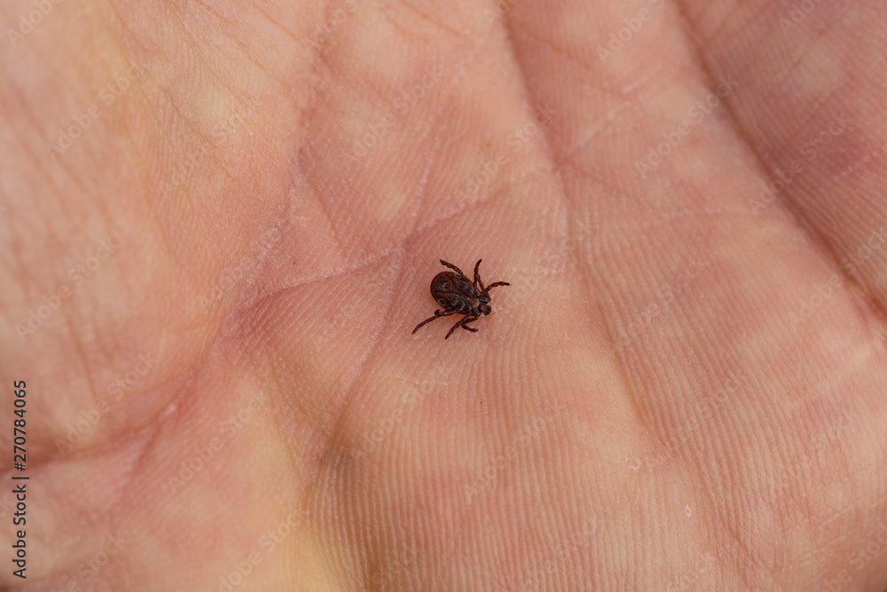Ixodes ricinus, the castor bean tick, is a chiefly European species of hard-bodied tick. Carrier Lyme disease and tick-borne encephalitis on the human arm. Ixodes ricinus, the castor bean tick, is a chiefly European species of hard-bodied tick. Carrier Lyme disease and tick-borne encephalitis on the human arm.