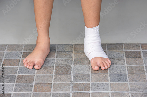 The  gauze bandages around the Ankle boy and leg swelling from inflammation.