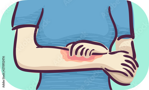 Girl Symptoms Itchy Skin Illustration