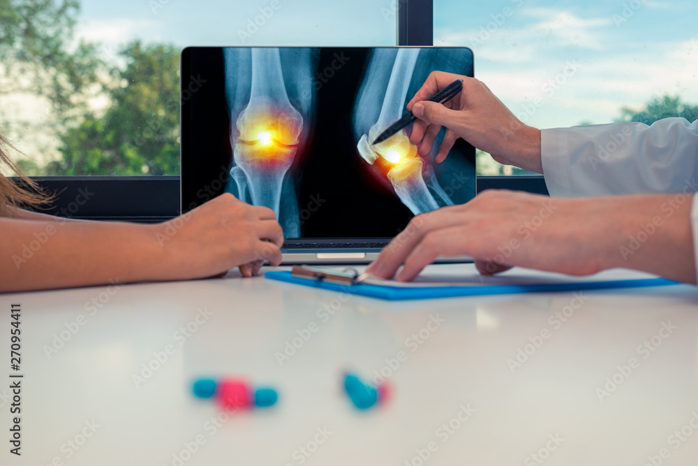 Doctor showing a x-ray of legs with pain in the knees on a laptop to a woman patient. Pills on the desk Doctor showing a x-ray of legs with pain in the knees on a laptop to a woman patient. Pills on the desk