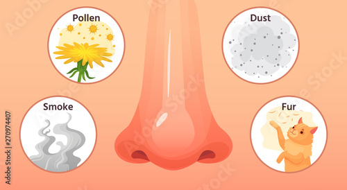 Allergic sickness. Red nose, allergy illnesses symptoms and allergens. Smoke, pollen and dust allergies cartoon vector illustration