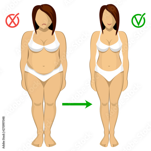 Fat and slim women. Woman body correction. Liposuction. Fitness. Fat and  slim woman figure before and after weight loss. Vector illustration. Stock  Vector | Adobe Stock