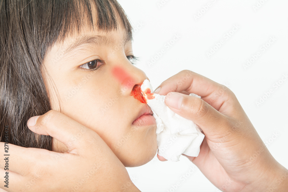 Bleeding in the nose of the child and clean hands Bleeding in the nose of the child and clean hands