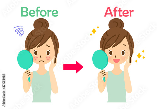ニキビを気にする女性　before　after　上半身