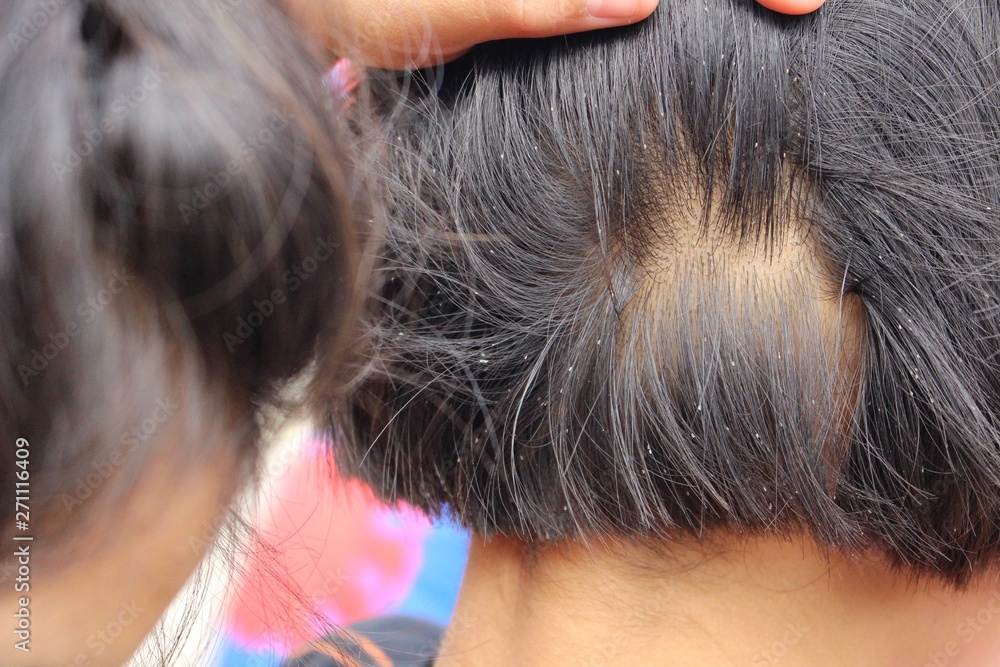 Obraz premium Girls lice on the head, filmed as blurred images