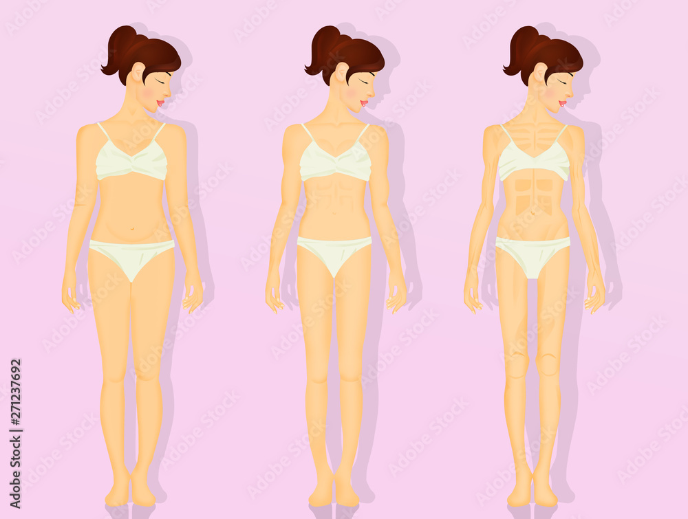illustration of girl with anorexia illustration of girl with anorexia