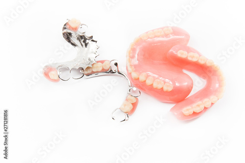 removable partial denture on white background.