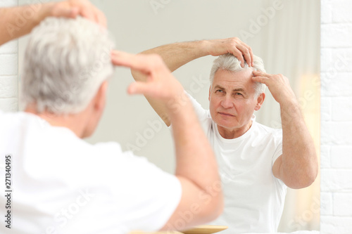 Senior man with hair loss problem looking in mirror indoors